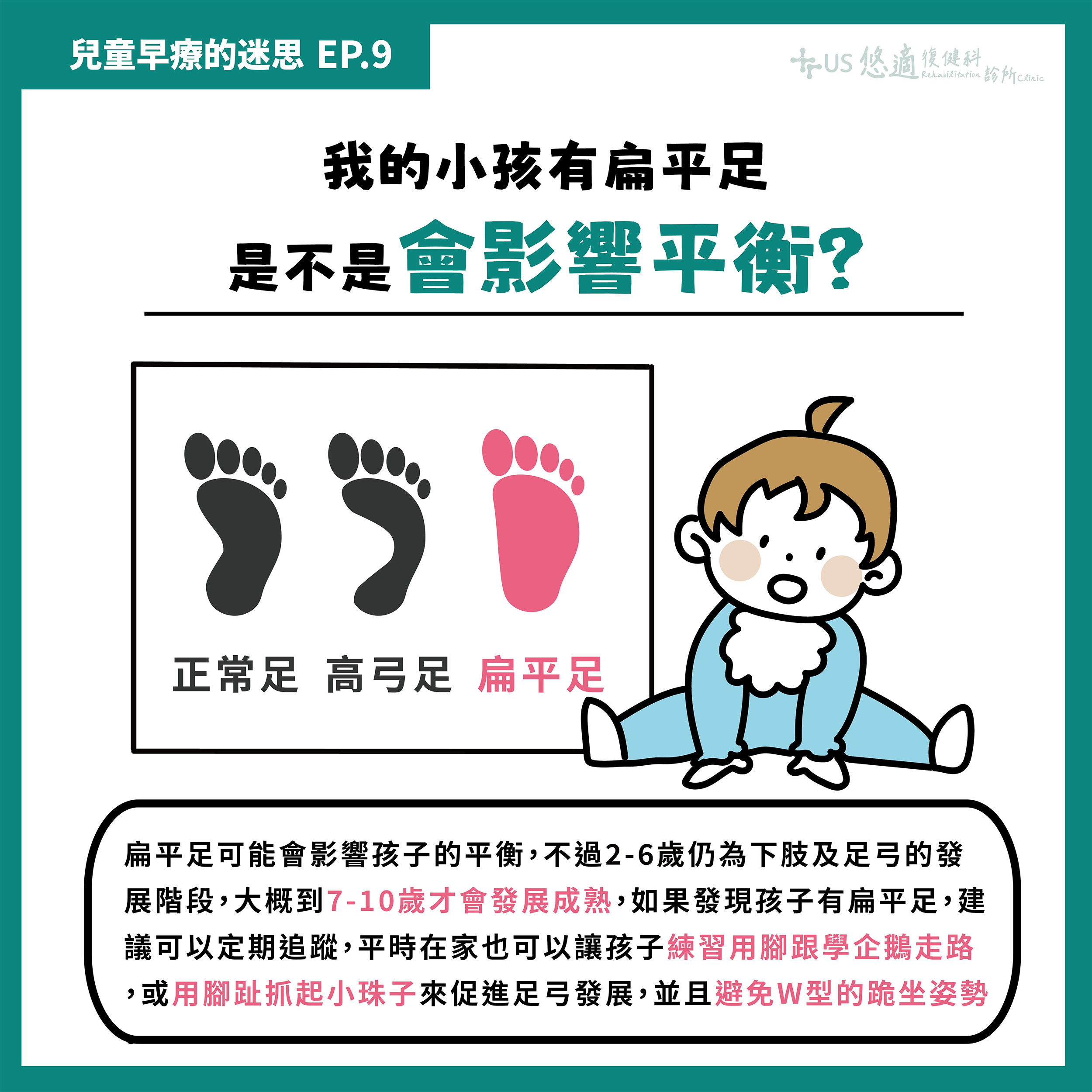 扁平足